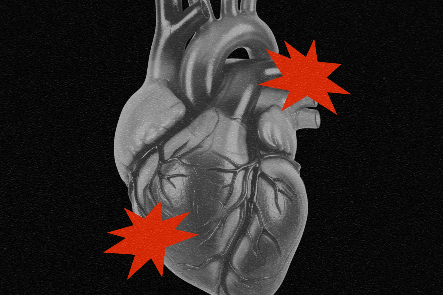 The New Way to Predict Your Risk of a Heart Attack