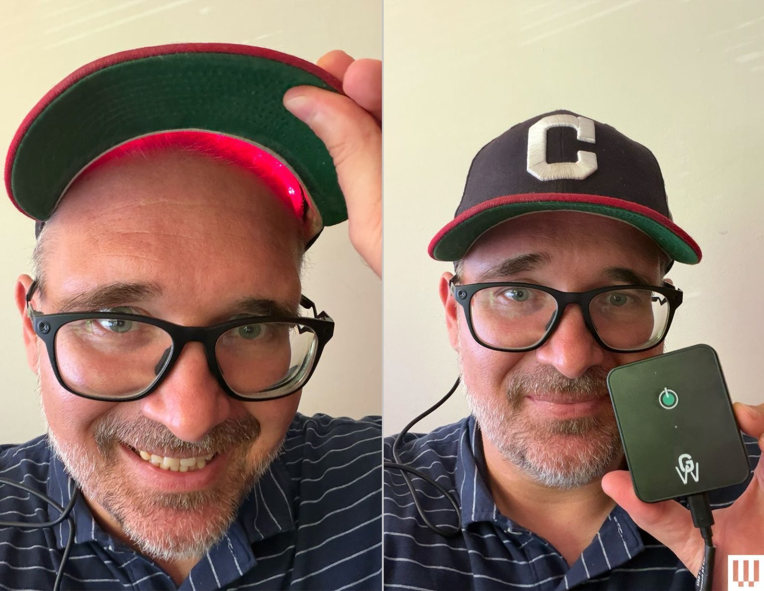 Image may contain Accessories Baseball Cap Cap Clothing Glasses Hat Face Head Person Photography and Portrait